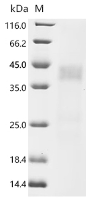 Recombinant Rat Asialoglycoprotein receptor 1 (Asgr1), partial (CSB-MP002207RA1b0) Recombinant Rat Asialoglycoprotein receptor 1 (Asgr1), partial (CSB-MP002207RA1b0)
