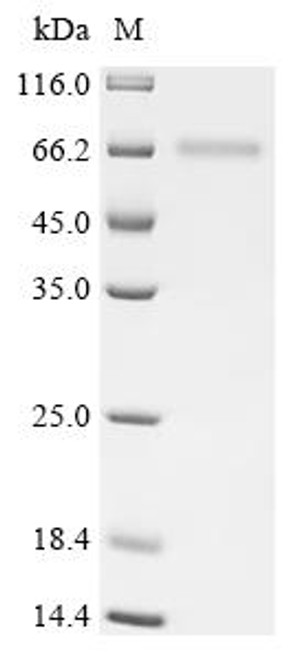 Recombinant Human Protein cereblon (CRBN) (CSB-MP842761HU) Recombinant Human Protein cereblon (CRBN) (CSB-MP842761HU)