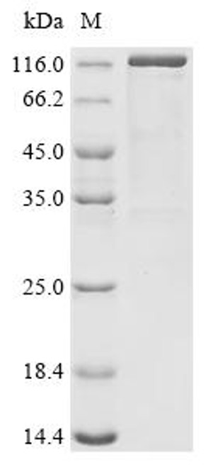 Recombinant Human Receptor-type tyrosine-protein phosphatase T (PTPRT), partial (CSB-MP019065HU) Recombinant Human Receptor-type tyrosine-protein phosphatase T (PTPRT), partial (CSB-MP019065HU)