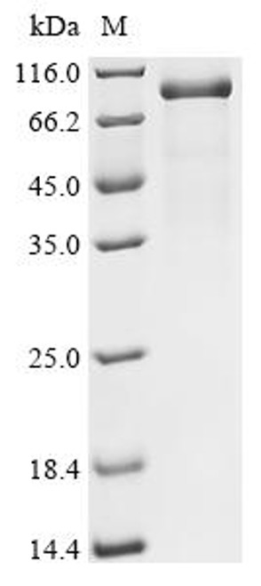 Recombinant Human Complement factor I (CFI) (CSB-MP005279HU) Recombinant Human Complement factor I (CFI) (CSB-MP005279HU)