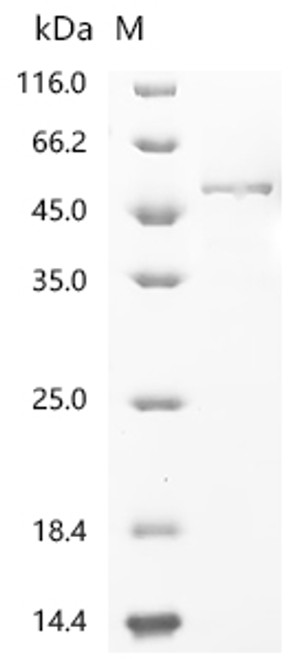 Recombinant Human Hyaluronidase-1 (HYAL1), partial (CSB-MP623651HUd9) Recombinant Human Hyaluronidase-1 (HYAL1), partial (CSB-MP623651HUd9)