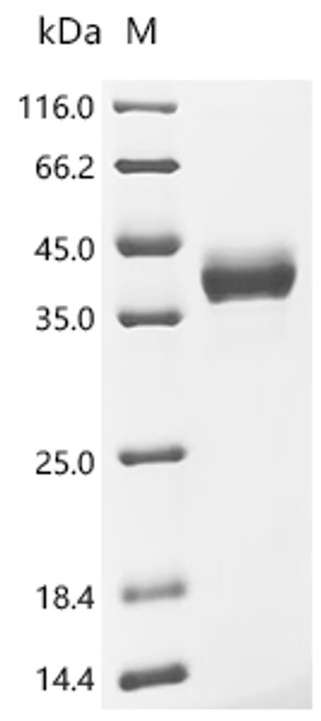 Recombinant Human Collagen alpha-1 (I) chain (COL1A1), partial (CSB-MP005727HU) Recombinant Human Collagen alpha-1 (I) chain (COL1A1), partial (CSB-MP005727HU)