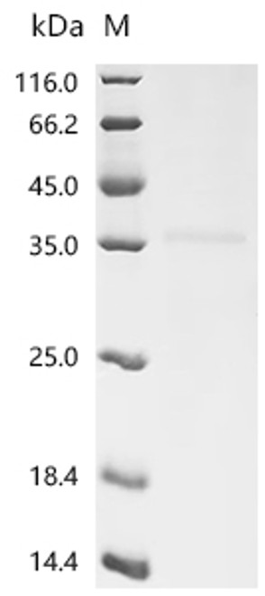 Recombinant Human metapneumovirus Matrix protein (M) (CSB-MP761526HDAMd7)