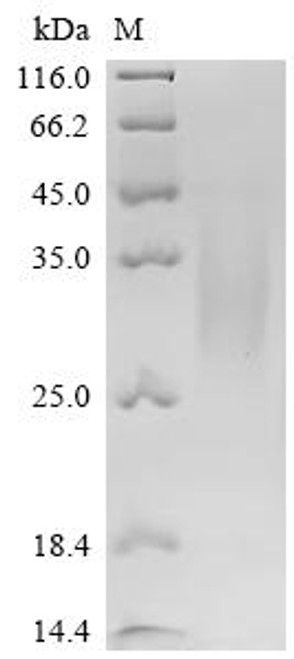 Recombinant Pig Parathyroid hormone/parathyroid hormone-related peptide receptor (PTH1R), partial (CSB-MP018988PI2)
