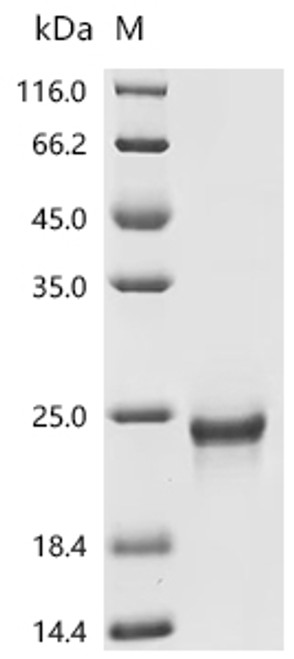 Recombinant Human Interferon alpha-2 (IFNA2) (Active) (CSB-MP360706HU)