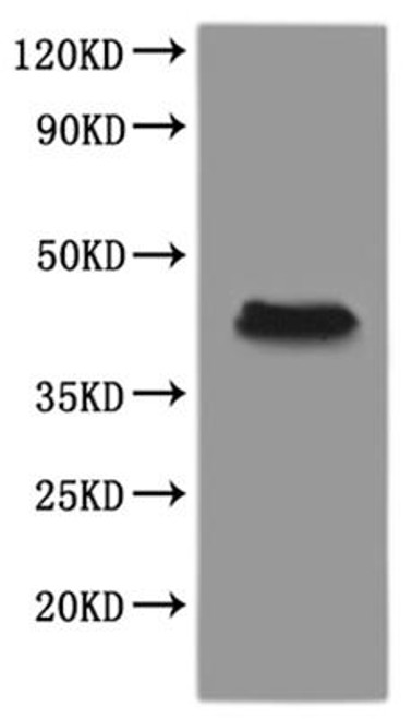 Recombinant Xenopus laevis Progestin and adipoQ receptor family member VIII L homeolog (paqr8.L)-VLPs (CSB-MP4097XBE)