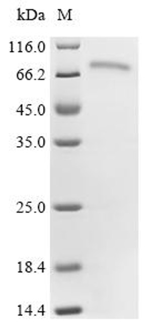 Recombinant Mouse CTP synthase 2 (Ctps2) (CSB-MP006177MO)