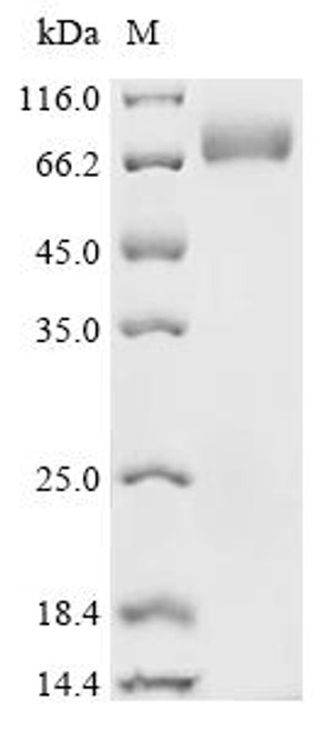 Recombinant Macrovipera lebetina Chymotrypsin-like protease VLCTLP (CSB-MP522192MPJ)