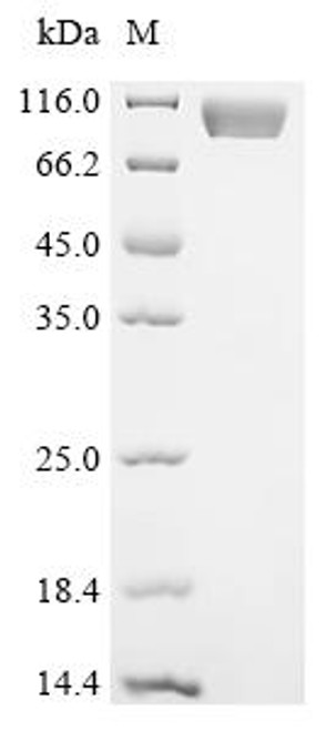 Recombinant Aspergillus fumigatus Protein ecm33 (ecm33) (CSB-MP684207NGS)
