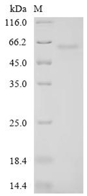 Recombinant Human RNA-binding protein PNO1 (PNO1) (CSB-MP885712HU)