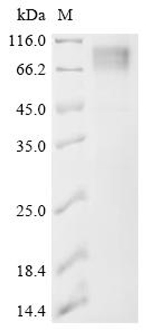 Recombinant Bovine leukemia virus Envelope glycoprotein (env), partial (CSB-MP326185BKF)