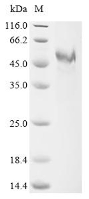 Recombinant Human Inter-alpha-trypsin inhibitor heavy chain H5 (ITIH5) , partial (CSB-MP768213HU)