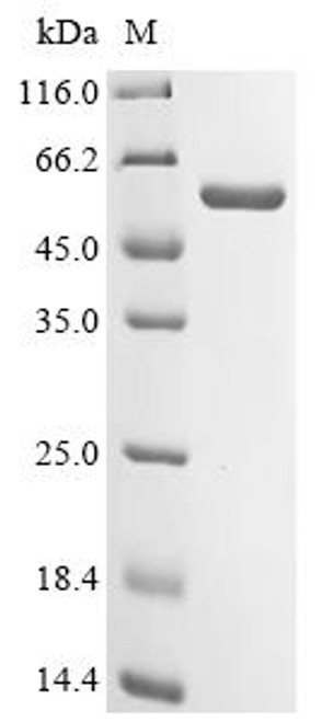 Recombinant Human Glutathione S-transferase A4 (GSTA4) (CSB-MP009973HU) Recombinant Human Glutathione S-transferase A4 (GSTA4) (CSB-MP009973HU)