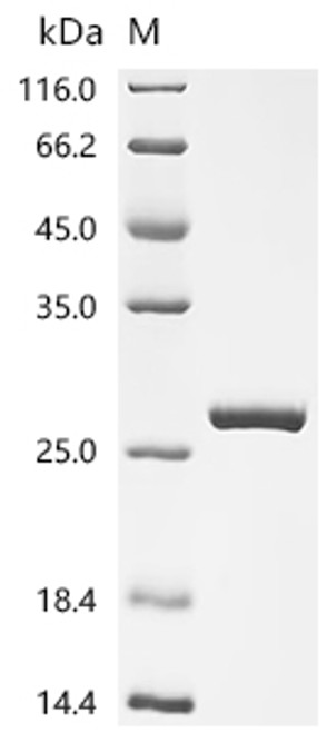 Recombinant Human Glutathione S-transferase A4 (GSTA4) (CSB-MP009973HUd7) Recombinant Human Glutathione S-transferase A4 (GSTA4) (CSB-MP009973HUd7)