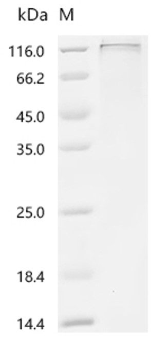 Recombinant Human Receptor-type tyrosine-protein phosphatase T (PTPRT), partial (CSB-MP019065HUd7)