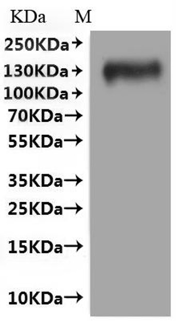 Recombinant Human Interleukin-10 receptor subunit alpha (IL10RA) (3-6: PCLV→GCVL)-VLPs (CSB-MP621688HU(A5)(M)) Recombinant Human Interleukin-10 receptor subunit alpha (IL10RA) (3-6: PCLV→GCVL)-VLPs (CSB-MP621688HU(A5)(M))