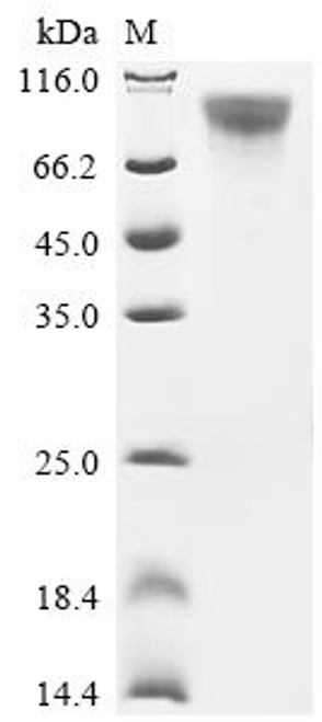 Recombinant Human Adhesion G protein-coupled receptor F5 (ADGRF5), partial (CSB-MP818271HU) Recombinant Human Adhesion G protein-coupled receptor F5 (ADGRF5), partial (CSB-MP818271HU)