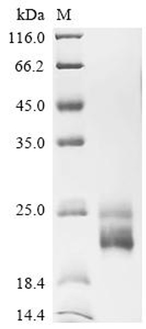 Recombinant Human Myelin-oligodendrocyte glycoprotein (MOG), partial (CSB-MP619083HU) Recombinant Human Myelin-oligodendrocyte glycoprotein (MOG), partial (CSB-MP619083HU)