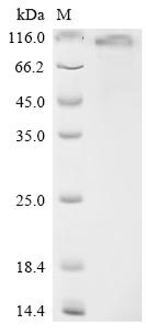 Recombinant Human NAD-dependent protein deacetylase sirtuin-1 (SIRT1) (CSB-MP822202HU) Recombinant Human NAD-dependent protein deacetylase sirtuin-1 (SIRT1) (CSB-MP822202HU)