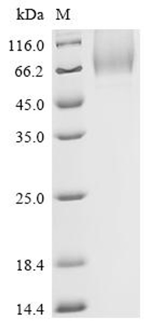 Recombinant Human CD44 antigen (CD44), partial (CSB-MP004938HU3(F1)) Recombinant Human CD44 antigen (CD44), partial (CSB-MP004938HU3(F1))