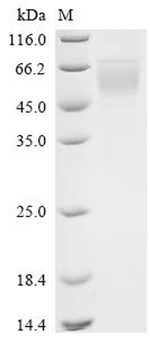 Recombinant Macaca mulatta Killer immunoglobulin-like receptor KIR3DL2 (KIR3DL), partial (CSB-MP5670MOW) Recombinant Macaca mulatta Killer immunoglobulin-like receptor KIR3DL2 (KIR3DL), partial (CSB-MP5670MOW)