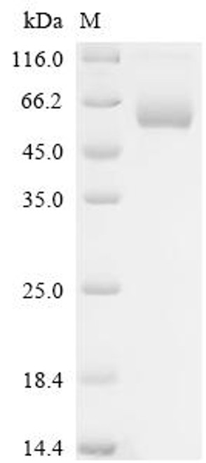 Recombinant Human C-type lectin domain family 9 member A (CLEC9A), partial, Biotinylated (Active) (CSB-MP740922HU-B) Recombinant Human C-type lectin domain family 9 member A (CLEC9A), partial, Biotinylated (Active) (CSB-MP740922HU-B)