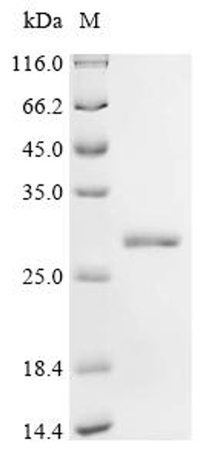 Recombinant Mouse COMM domain-containing protein 9 (Commd9) (CSB-EP816989MOe1)
