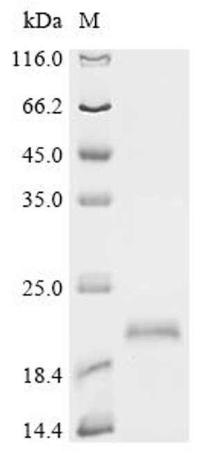 Recombinant Pseudopleuronectes americanus Ice-structuring protein 3 (B16D,B26D,B27D) (CSB-EP360877FGV)