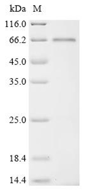 Recombinant Gorilla gorilla gorilla Tyrosine-protein kinase (LCK) (C378S) (CSB-EP5774GKM(M2))