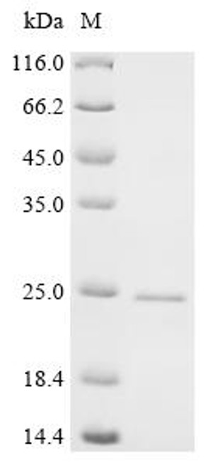 Recombinant Mouse Synaptic vesicle glycoprotein 2A (Sv2a), partial (CSB-EP022978MO)