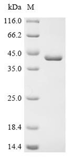 Recombinant Escherichia coli Thiamine-binding periplasmic protein (thiB) (CSB-EP330093ENV)