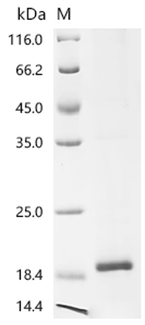 Recombinant Galleria mellonella Odorant-binding protein (OBP7) (CSB-EP5473GET)