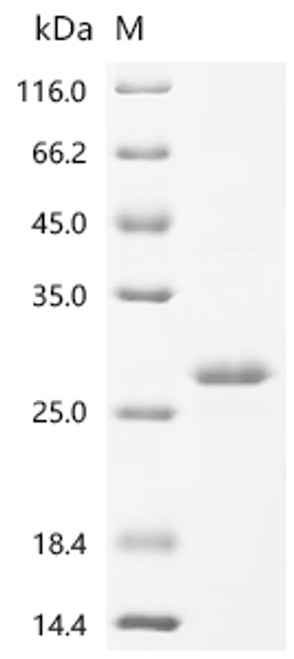 Recombinant Brucella abortus OmpA-like transmembrane domain (CSB-EP5775BMN)