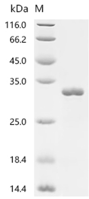 Recombinant Arabidopsis thaliana Transcription factor TCP21 (TCP21) (CSB-EP872319DOA)