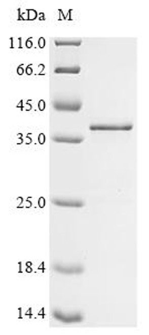 Recombinant Human Hepatoma-derived growth factor-related protein 3 (HDGFL3) (CSB-EP896712HU)