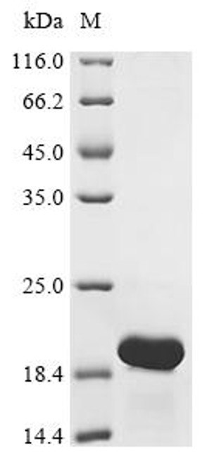 Recombinant Pseudomonas syringae pv. tomato Copper resistance protein C (copC) (CSB-EP318232PWG)