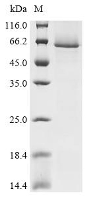Recombinant Human TNF receptor-associated factor 2 (TRAF2) (CSB-EP024147HUa0)