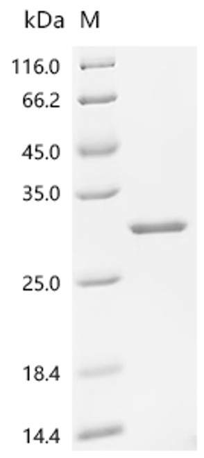 Recombinant Human Ciliary neurotrophic factor (CNTF) (CSB-EP005683HUb0)