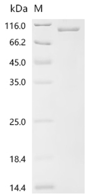 Recombinant Human Importin subunit beta-1 (KPNB1) (CSB-EP622929HU(A4))