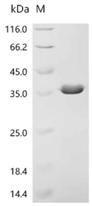Recombinant Staphylococcus aureus Iron-regulated surface determinant protein H (isdH), partial (CSB-EP858191SKY)