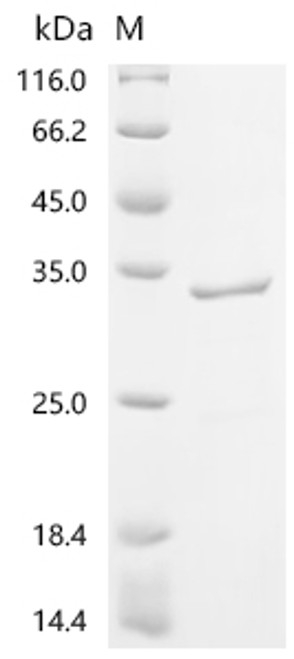 Recombinant Human Pulmonary surfactant-associated protein A1 (SFTPA1) (CSB-EP810281HU)
