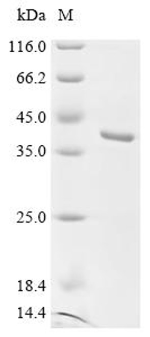 Recombinant Human Fibroblast growth factor 5 (FGF5) (CSB-EP008632HUc7)