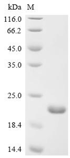 Recombinant Salmonella typhimurium SPI-1 type 3 secretion system translocon protein SctE (sctE1), partial (CSB-EP681910SXB1e1)