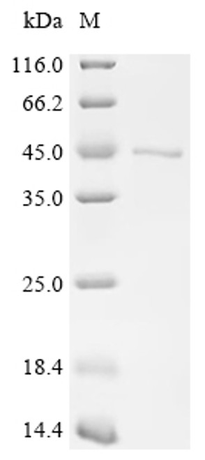 Recombinant Human E3 ubiquitin-protein ligase RBX1 (RBX1) (CSB-EP019496HUf0)