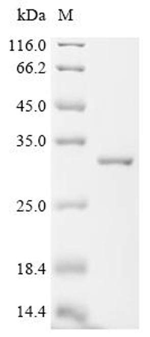 Recombinant Human Ferritin heavy chain (FTH1) (H106A) (CSB-EP009030HU(M1))