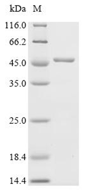Recombinant Shigella flexneri Putative multidrug resistance protein MdtA (mdtA) (CSB-EP774494SZB)
