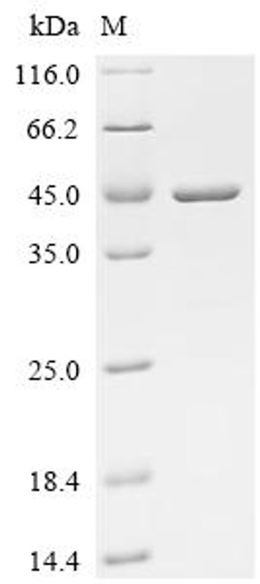 Recombinant Shigella flexneri Outer membrane protein assembly factor BamC (bamC) (CSB-EP364253SZB)