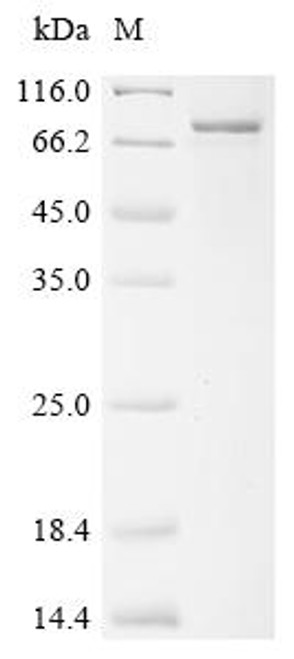 Recombinant Human E3 ubiquitin-protein ligase XIAP (XIAP) (1-1:M→MM) (CSB-EP026193HU(M))