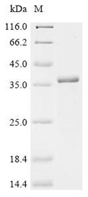 Recombinant Mouse Mannose-binding protein C (Mbl2) (CSB-EP013540MO)
