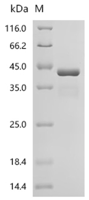 Recombinant Human Prickle-like protein 2 (PRICKLE2), partial (CSB-EP773783HU1)